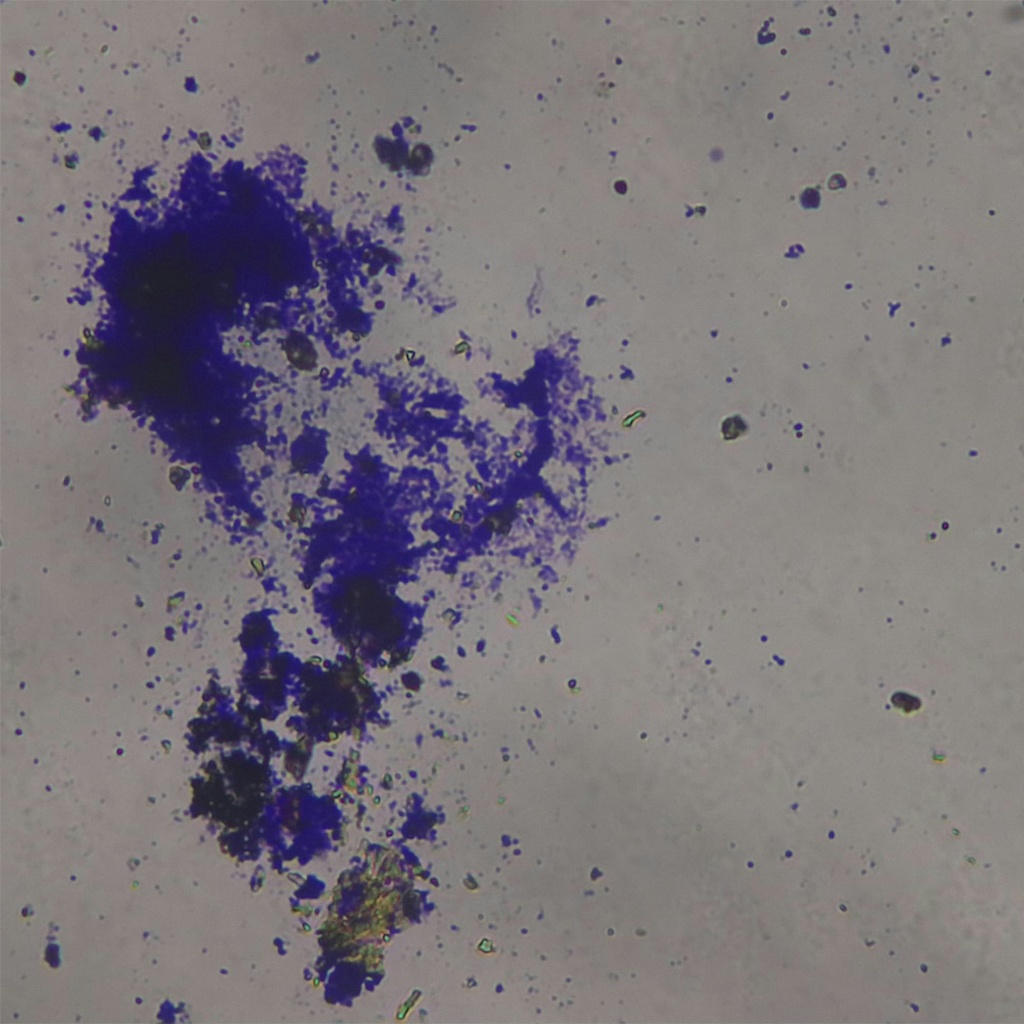 Preparación microscópica de streptococo en cadenas