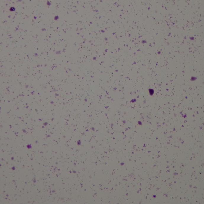 Preparación microscópica de staphylococcus aureus