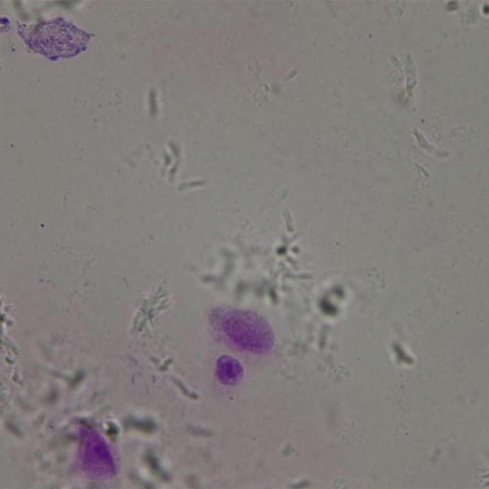 Preparación microscópica de cromosoma XX (hembra)