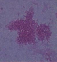 Preparación microscópica de 3 Tipos de bacterias (streptococcus, bacillus y spirillum)