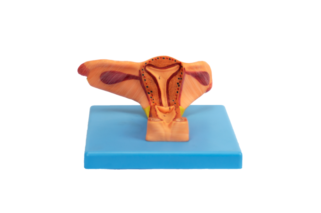 Modelo de la matriz