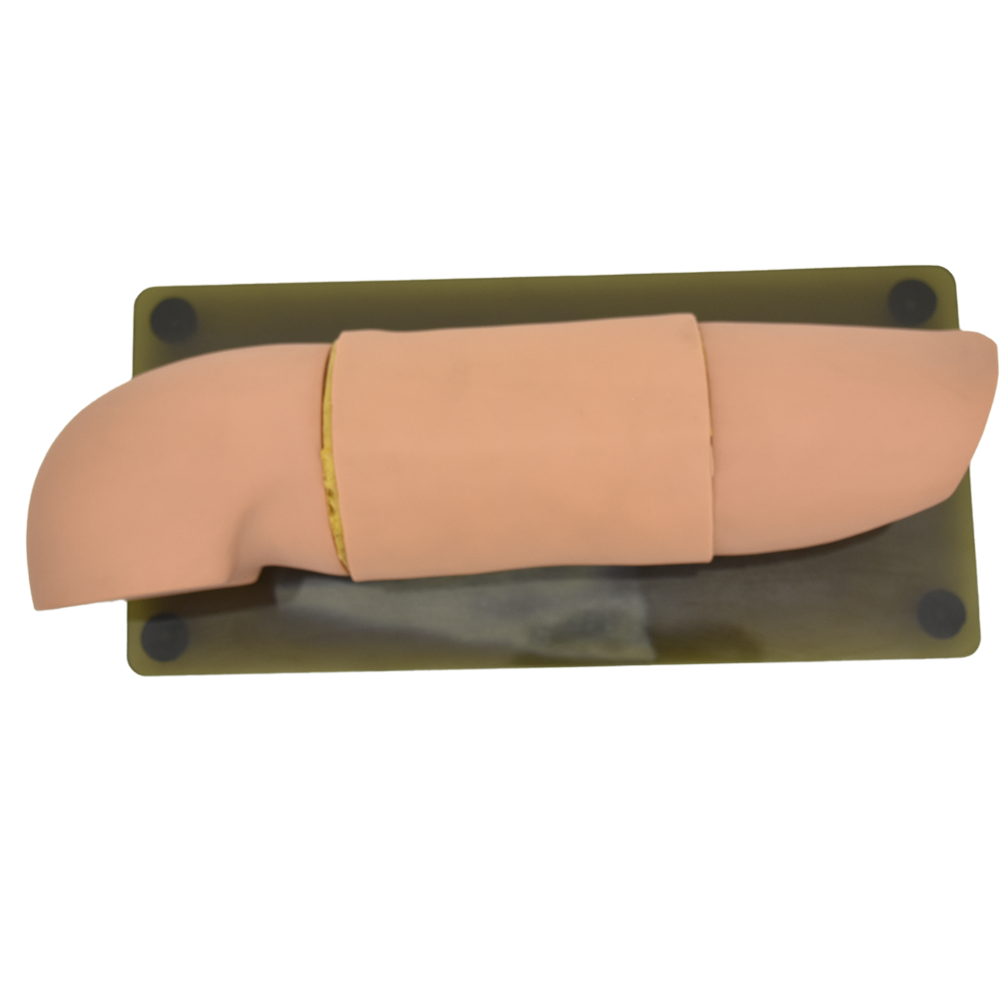 Brazo para colocación y remoción de material anticonceptivo