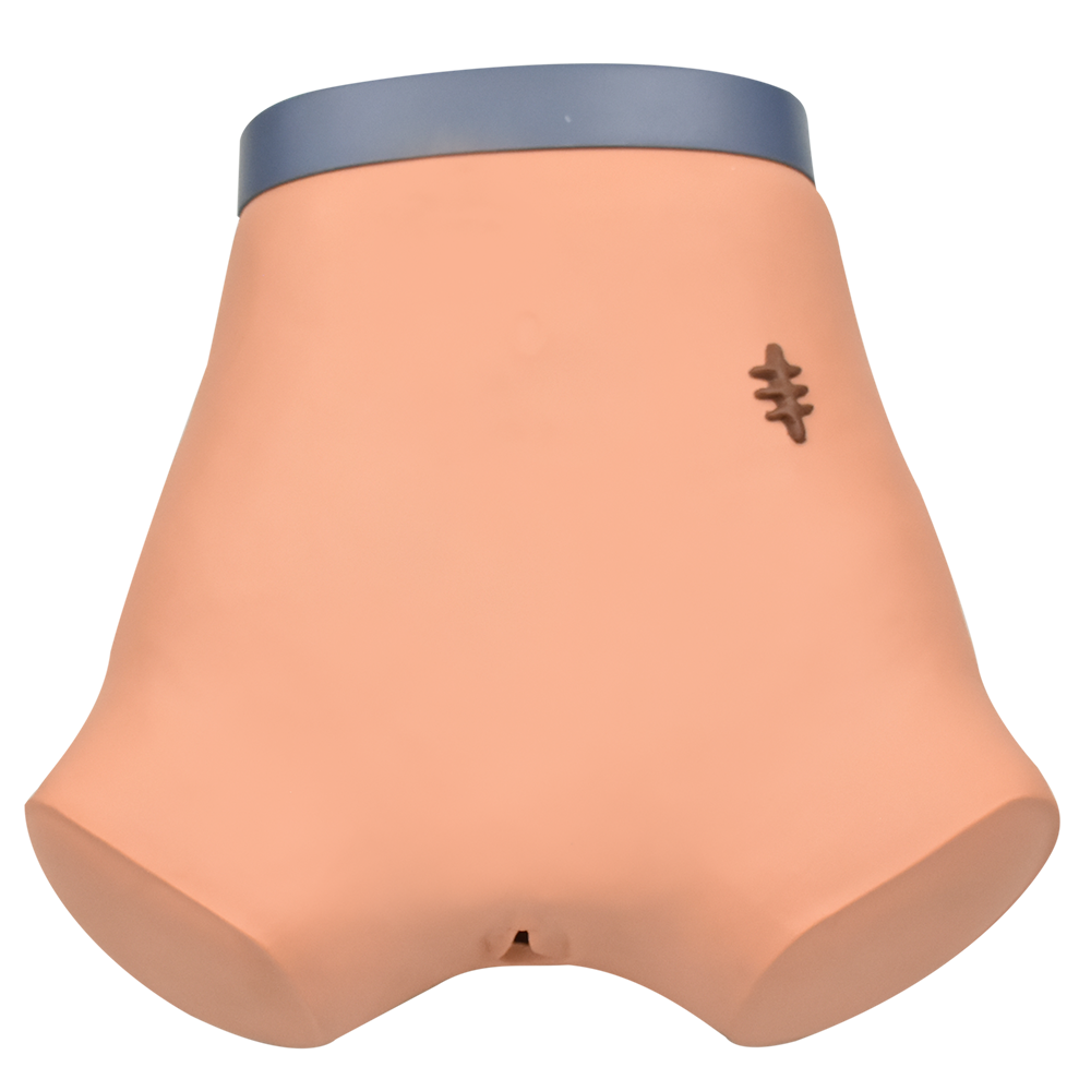 Caterización y punción abdominal