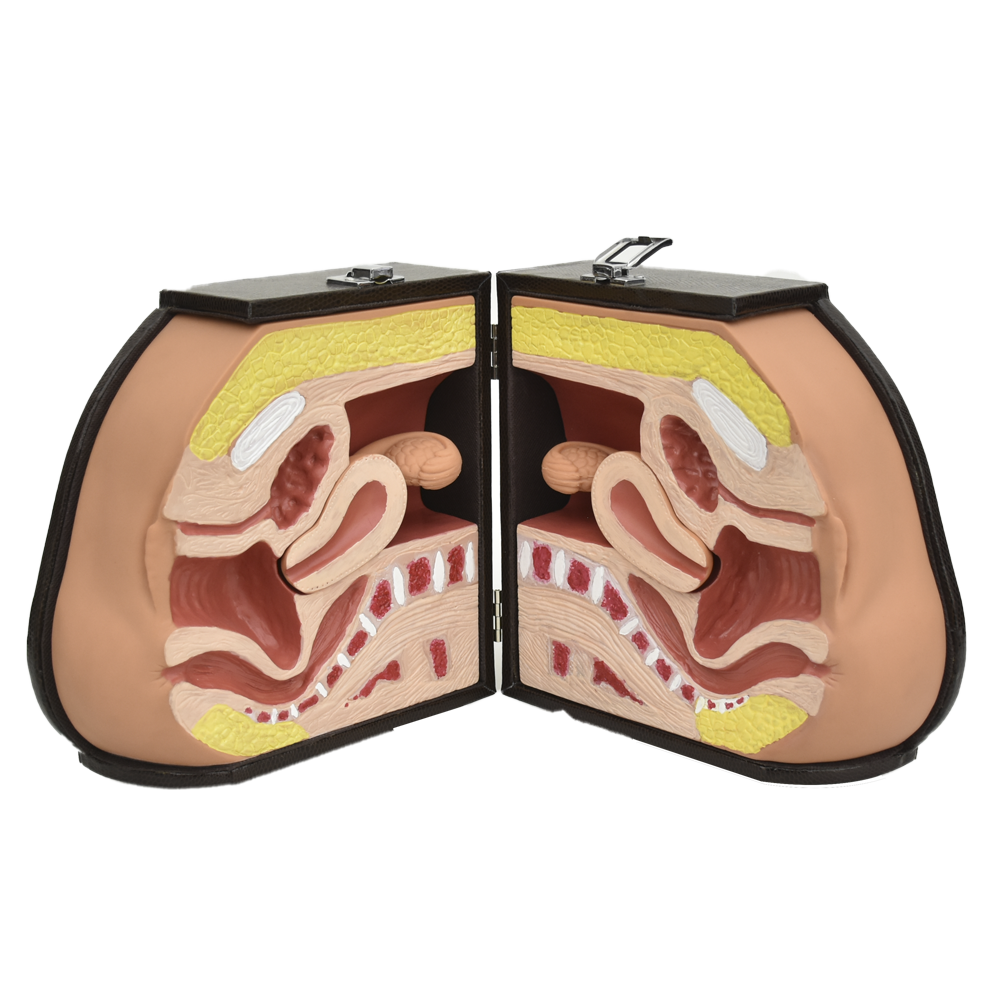 Simulador avanzado de entrenamiento para dispositivo diu