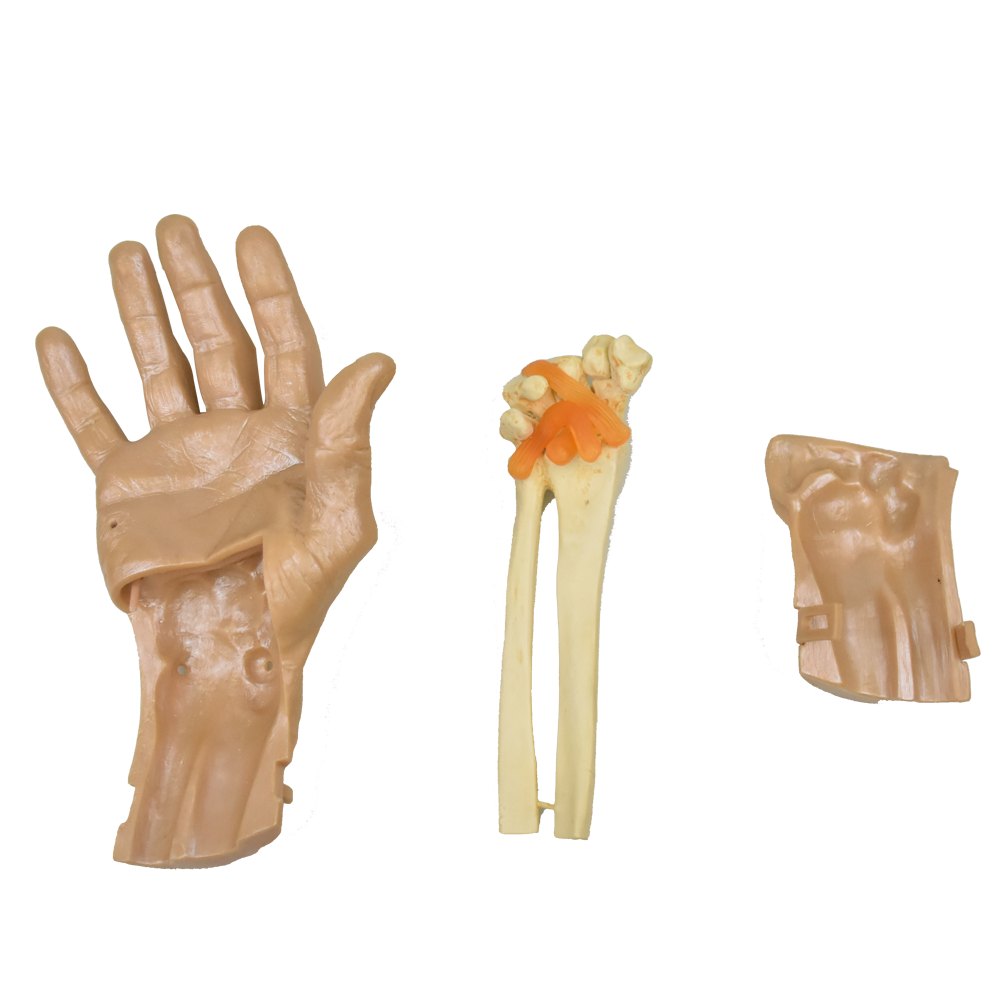 Simulador para realizar artroscopia de mano