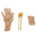 Simulador para realizar artroscopia de mano