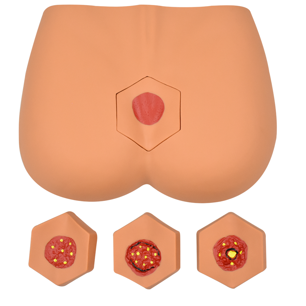 Simulador para el cuidado de la úlcera/etapa decúbito