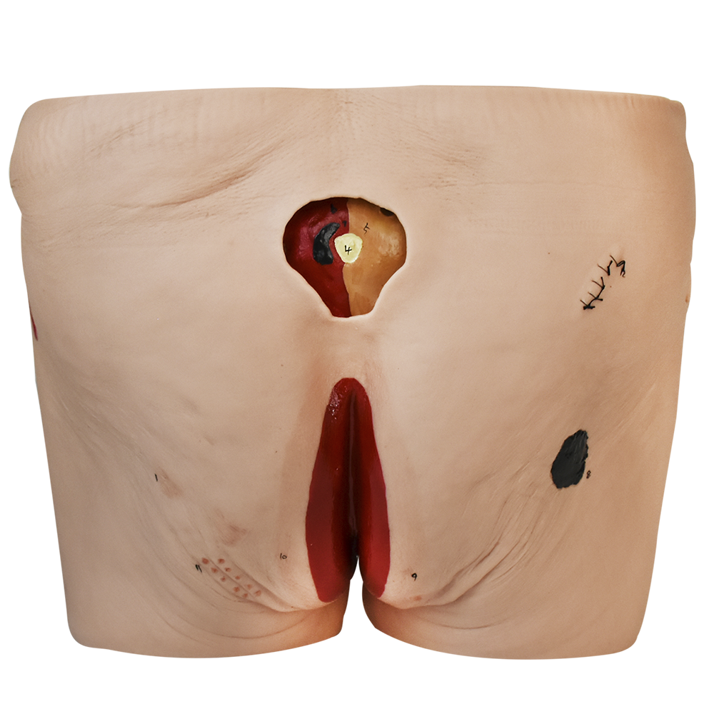 Simulador de cuidados de ulcera de decubito