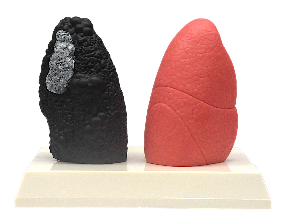 Modelo anatómico de comparasión de pulmón sano con enfermo