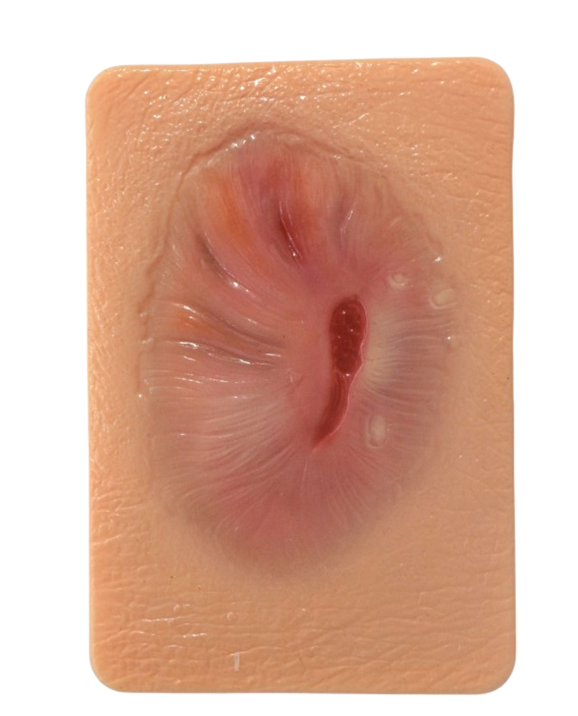 Simulador de tejido con granulación madura