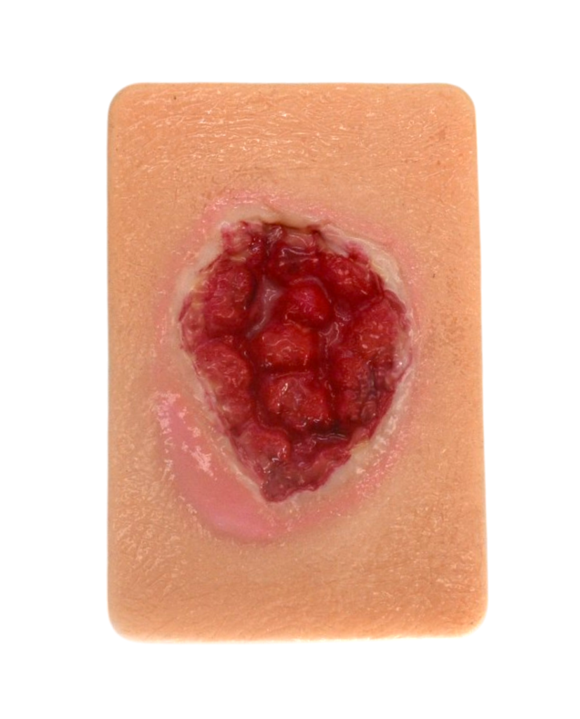 Simulador de tejido con granulación madura (copia)