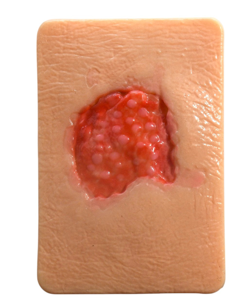 Simulador de tejido con granulación sana