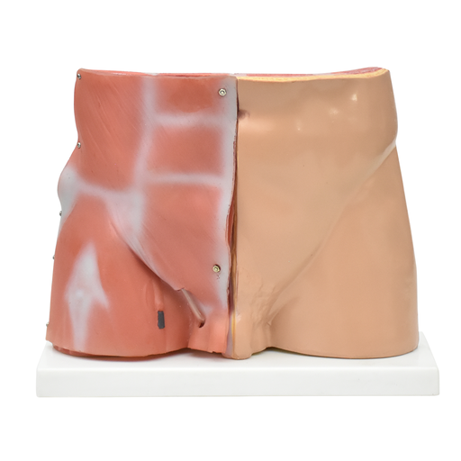 [PEL-ING] Pelvis masculina inguinal