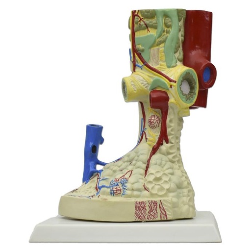 [ALV-GIG] Alveolo pulmonar gigante