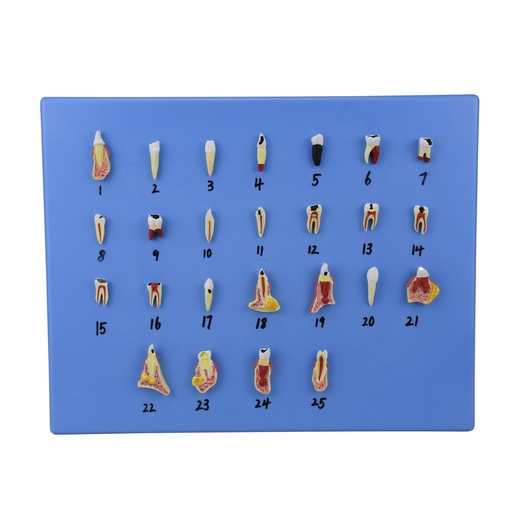 [DIE-ENF] Modelo de dientes con padecimientos