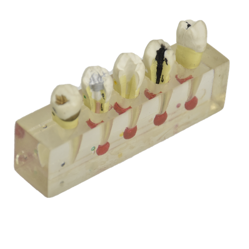 [DENT-END] Modelo anatómico de endodoncia
