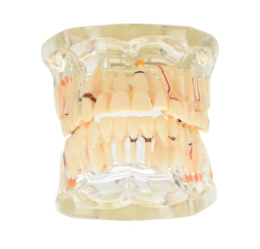 [DENT-DIE-R] Tipodondo adulto transparente