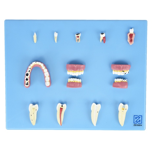 [DENT-ENF] Modelo de enfermedades dentales