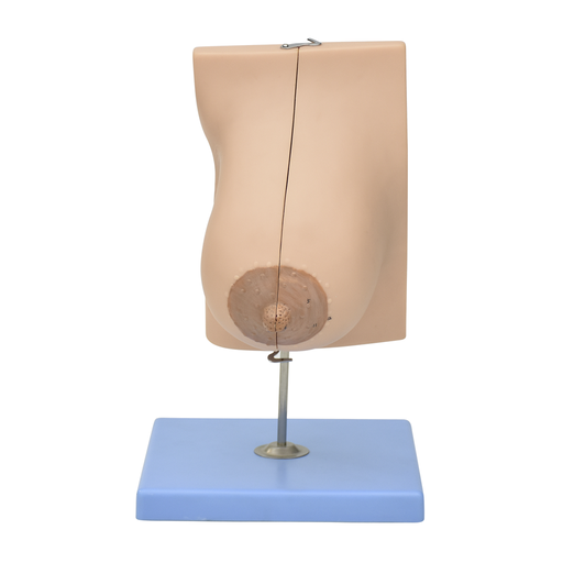 [GLA-MAM-LAC] Glandula mamaria en lactancia