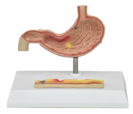 [EST-ENF] Estomago enfermo