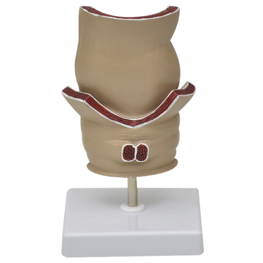 [RECTO] Modelo de recto con patologias