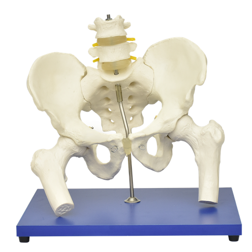 [COL-FEMO] Pelvis con columna lumbar y cabeza femoral