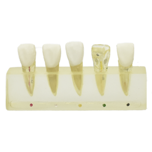 [DENT-END-2] Modelo clínico de endodoncia