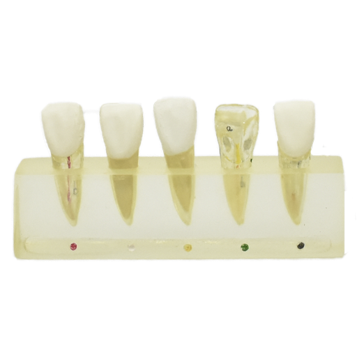 [DENT-END-2] Modelo clinico de endodoncia