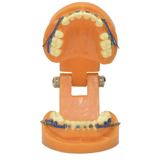 [DENT-ORTO] Dentadura para ortodoncia