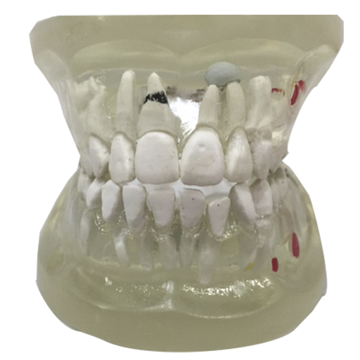 [DENT-TRA-ENF] Mandíbula con patologías dentales