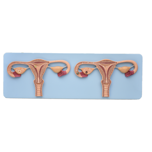 [SIS-UTE] Modelo de fertilización