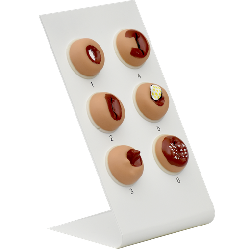 [CERV-ENF] Modelo de lesiones en cervix