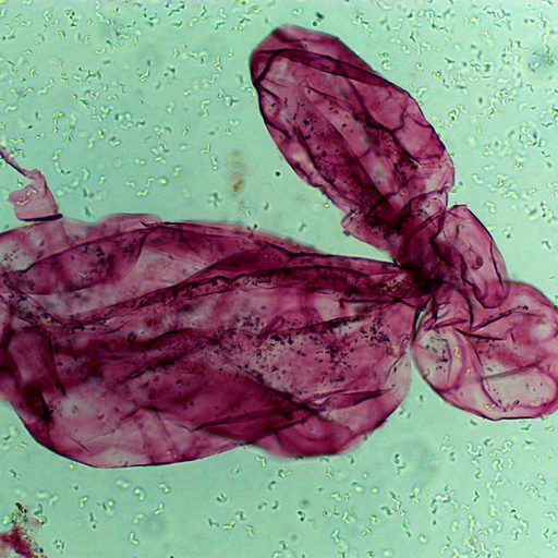 [PR-212] Preparación microscópica de pulpa de tomate tejido blando