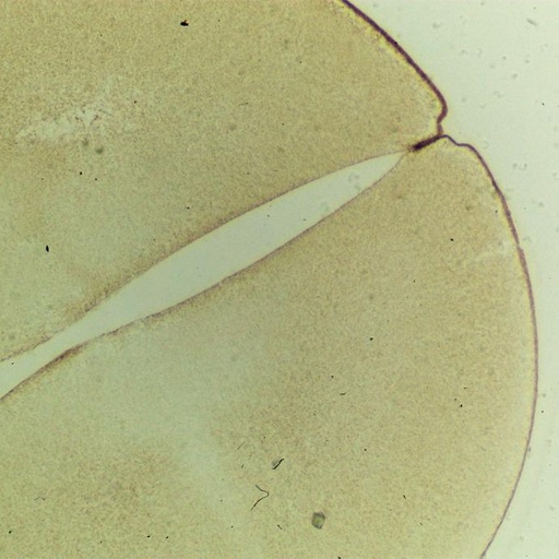 [PR-028] Preparación microscópica de huevo de rana con división a 2 células