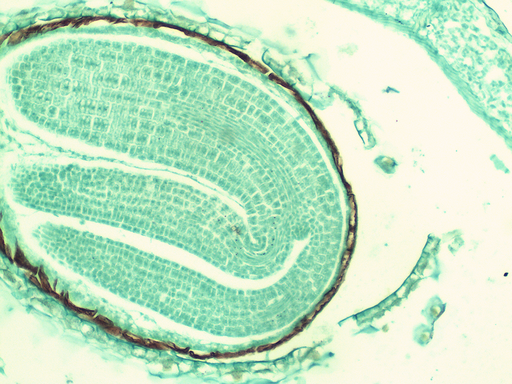 [PR-041] Preparación microscópica de capsella