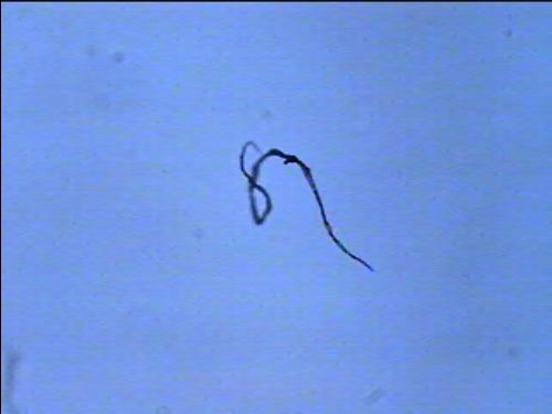 [PR-086] Preparación microscópica de schistosoma cercaria wm