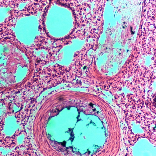 [PR-151] Pulmón de conejo inyectado