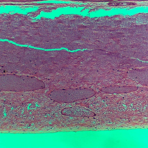 [PR-168] Preparación microscópica de vesícula biliar de puerco