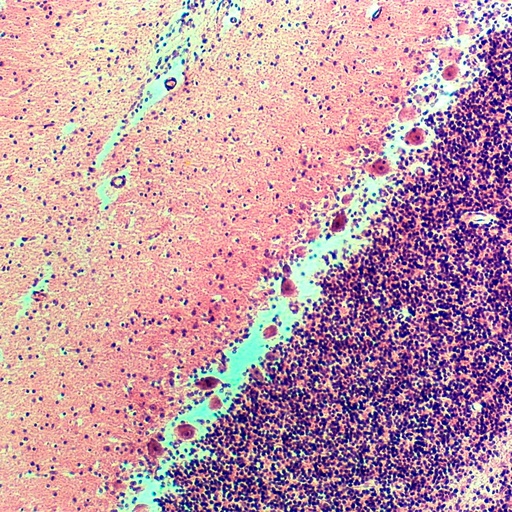 [PR-187] Cerebelo mamifero