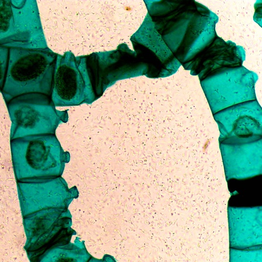 [PR-192] Preparación microscópica de schistosoma tipo de gusano plano parásito en cópula