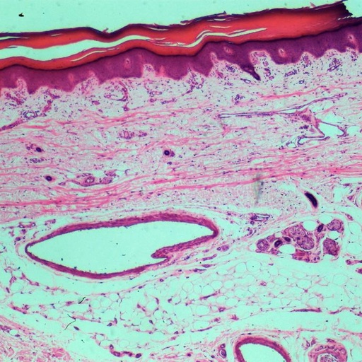 [PR-045] Preparación microscópica de gláncula sudorípara