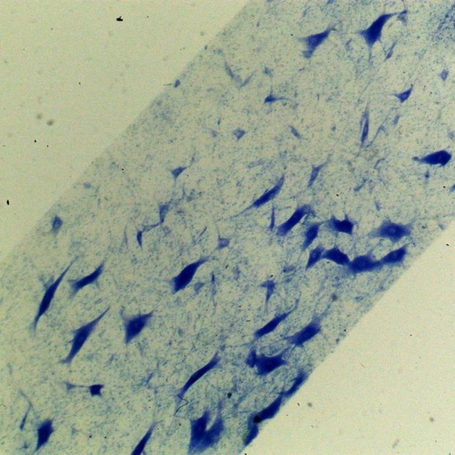 [PR-052] Preparación microscópica de motoneurona o neurona motora de puerco