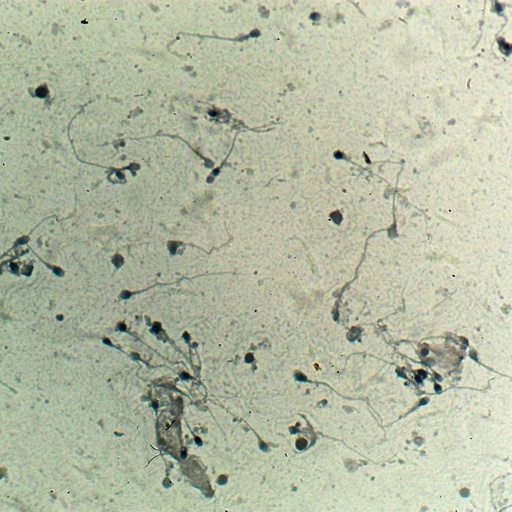 [PR-067] Preparación microscópica de espermatozoides