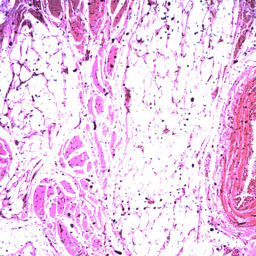 [PR-178] Cuero cabelludo con foliculo