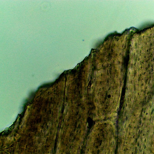 [PR-180] Seccion de diente