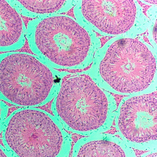 [PR-163] Tejido ductos espermáticos