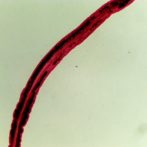 [PR-083] Preparación microscópica de schistosoma tipo de gusano plano parásito hémbra