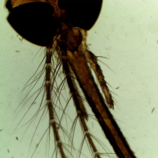 [PR-117] Preparación microscópica de partes de boca de mosquito