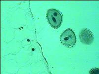 [PR-096] Preparación microscópica de granos de polen de lirio