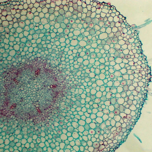 [PR-182] Preparación microscópica de raíz joven de frijol